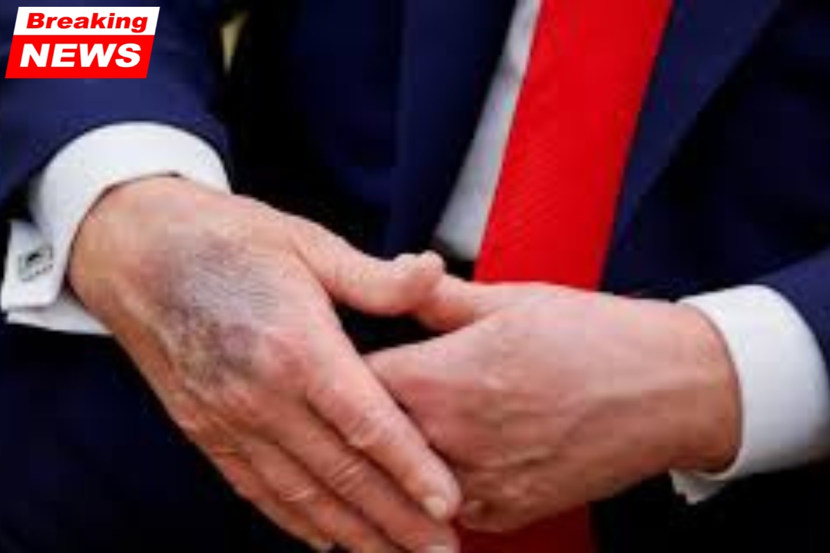 Trump's physical results are released by the White House, which claims he is in "excellent health" but nearly obese